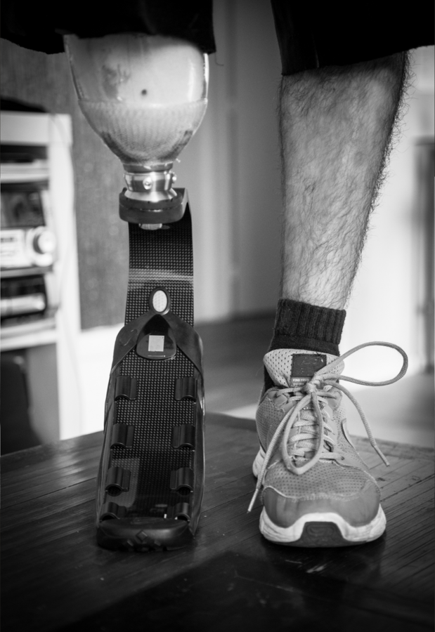 Une lame de course en carbone montée sur une prothèse, posée à côté d'une chaussure de sport.
